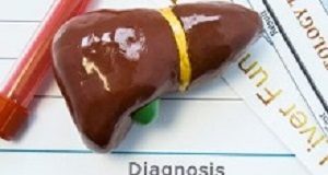 Quick test developed to detect liver damage Liverfibrosis