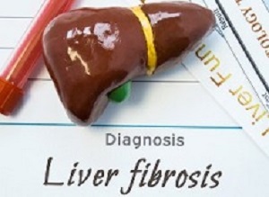 Liverfibrosis