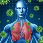 Pneumonia