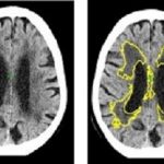 brainscans