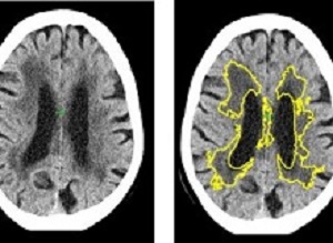 brainscans