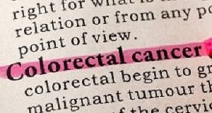 ACS recommends earlier colorectal cancer screening Colorectal