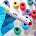HIV