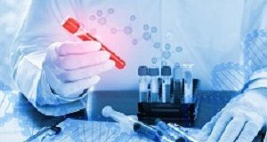 Antibody blood test to detect melanoma in its early stages Bloodtest