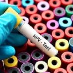 HPVtest