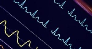 Not true that large chunks of healthcare spending go to futile end-of-life care Colorful ECG waves on the hospital monitor