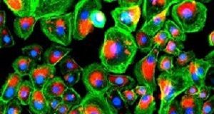 Regenerative bandage for diabetic ulcers epidermis