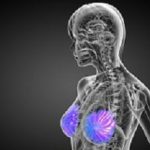 Mammogram