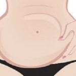Bellyfat