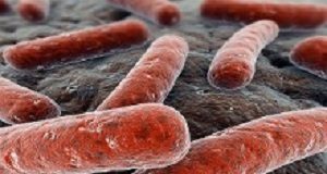 Higher levels of natural killer cells associated with latent TB Tuberculosis