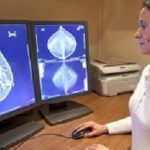 Radiology technician examens mammography test