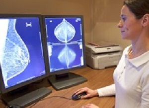 Radiology technician examens mammography test