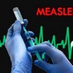 Measles