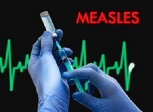 Measles