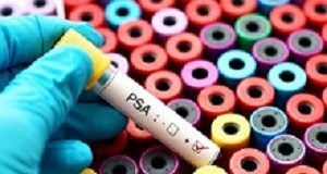 Routine prostate cancer testing not recommended — international panel PSA