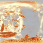 Klebsiella