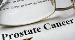 Radiotherapy plus standard treatment improves prostate cancer survival Prostate