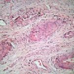 Cervix