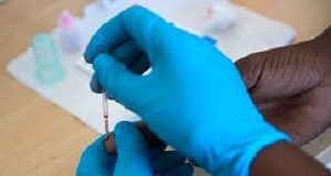 UCT in infectious diseases treatment breakthrough PredART