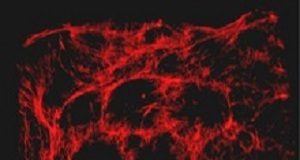 Injectable, low-cost hydrogel helps wounds heal faster hydrogel