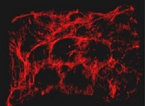 hydrogel