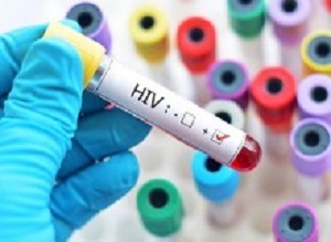 HIVtest