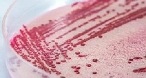 First listeriosis class action claims may be paid out in 2020 Listeriosis