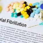 Fibrillation