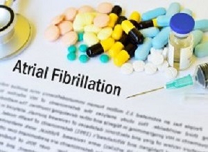 Fibrillation