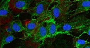 Japanese stem cell research 'dangerous and unwise' Mesenchymal