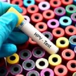 HPVtest