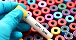 NHS research shows HPV screening practical and more efficacious than cytology HPVtest