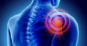 Expert panel strongly recommends against almost all shoulder pain surgery Shoulderpain
