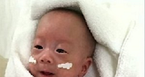 Smallest baby ever to survive goes home Baby