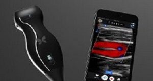 Hand-held ultrasound scanner shows its potential in rural Africa ButterflyIQ