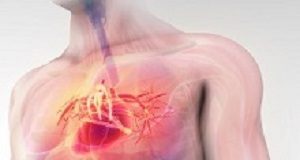 Presence of coronary calcium predicts heart attack risk Calcium