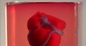 Researchers print 3D heart with some of patient's own cells Heart