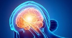 Three or more caffeinated drinks could trigger migraines Migraine