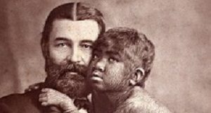 Medicine mix-up causes 'werewolf syndrome' in Spanish children Wikimedia