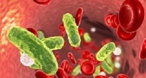 New test assists with quicker treatment decisions for sepsis Sepsis
