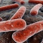 Tuberculosis