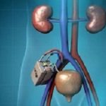 Kidney