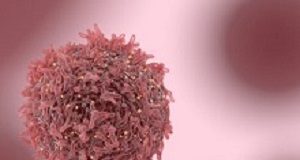 Public fixation on cancer 'cure' masks dramatic progress Cancer