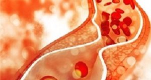 Landmark study highlights importance of cholesterol monitoring of young adults Cholesterol