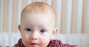 No evidence for daily emollient to prevent infant eczema Baby