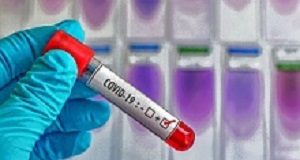 The case for healthcare worker screening to prevent hospital transmission Lab-1