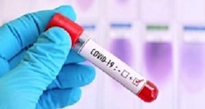 Poor reporting fans damaging African backlash over vaccine testing and usage Lab