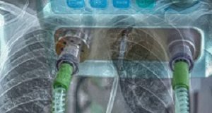 COVID-19: Intensive Care Society issues new guidelines on ‘proning’ Lungs