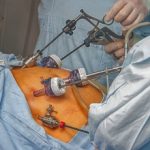 Bariatric