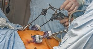 Calls for expansion of bariatric surgery to lessen impact of COVID-19 Bariatric